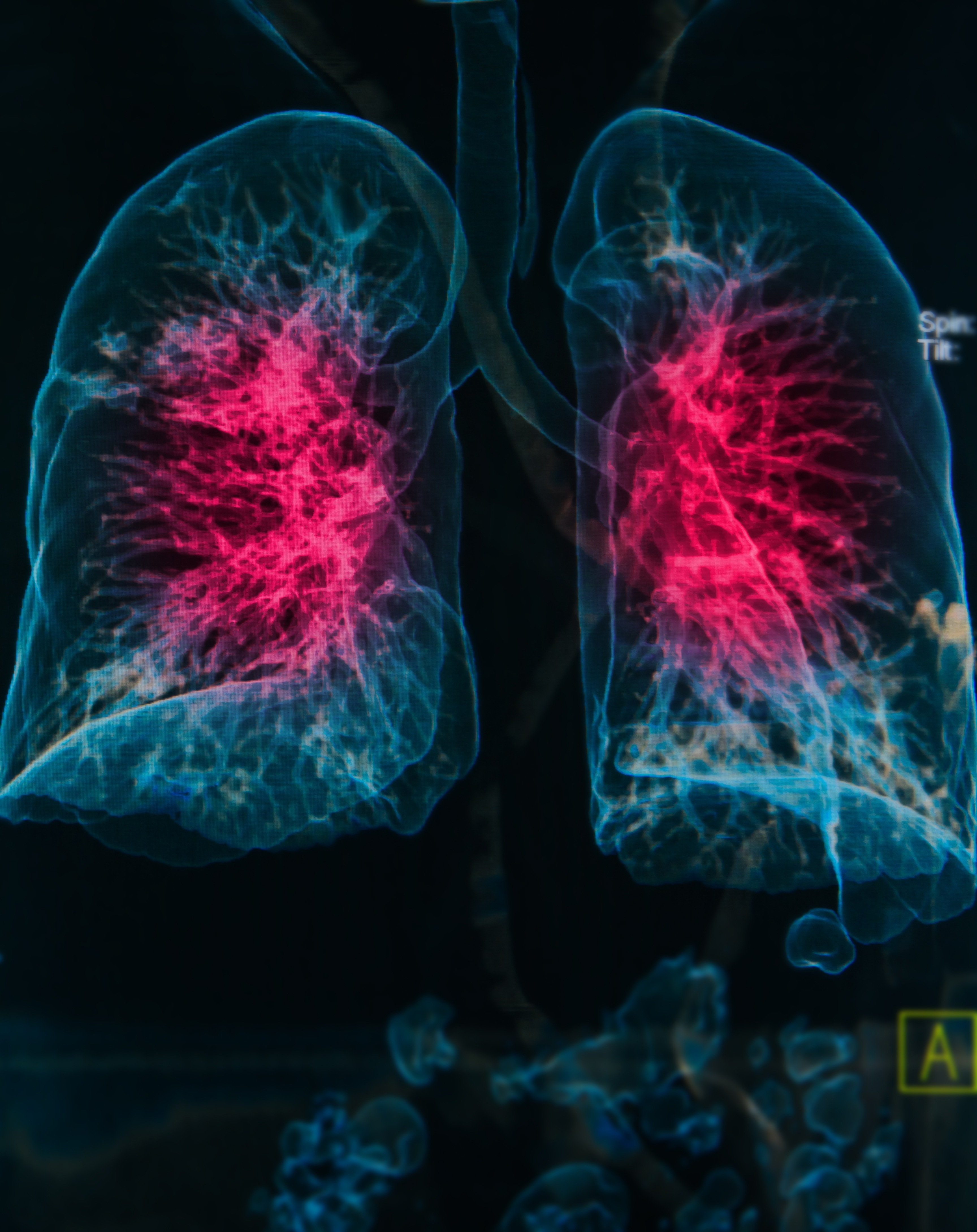 Forum on this topic: GERD and Scleroderma, gerd-and-scleroderma/ Communication on this topic: GERD and Scleroderma, gerd-and-scleroderma/