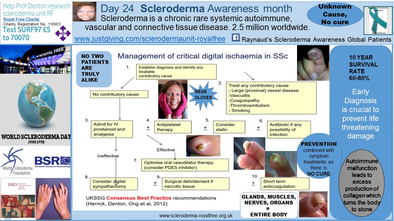 Early facial changes associated with scleroderma