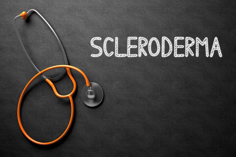 Image result for Scleroderma, Systemic Sclerosis and Cannabis